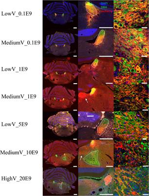 Optimized Parameters for Transducing the Locus Coeruleus Using Canine Adenovirus Type 2 (CAV2) Vector in Rats for Chemogenetic Modulation Research